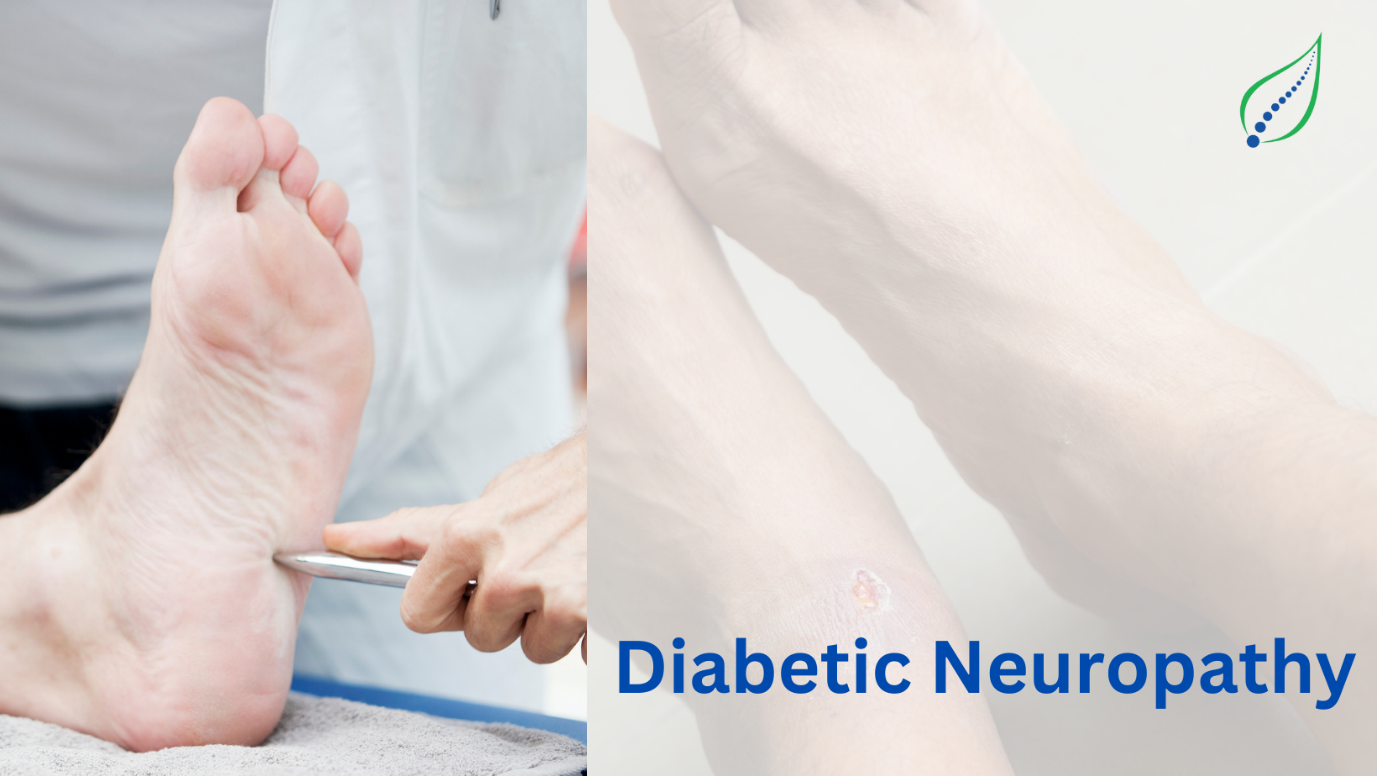 Diabetic Neuropathy